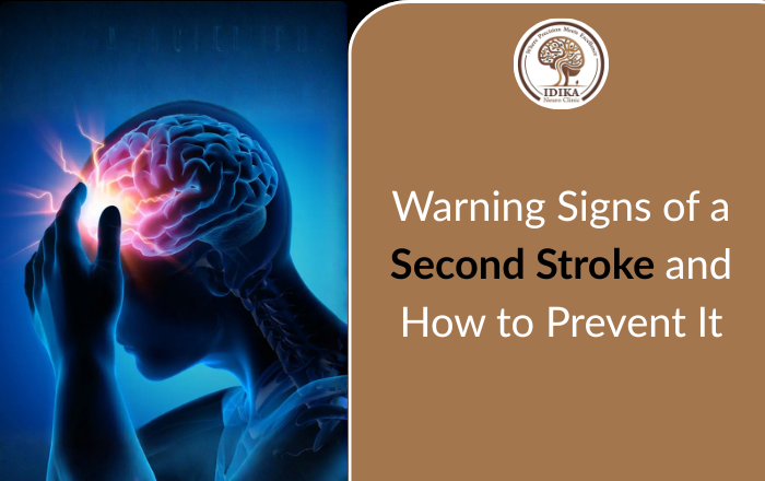 Warning Signs of a Second Stroke and How to Prevent It